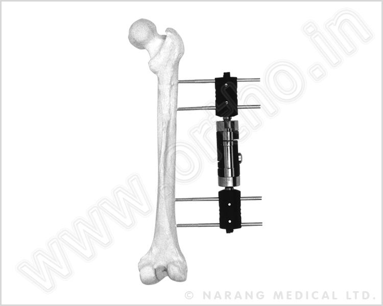 Dynamic Axial Extenal Fixator (Straight Type) - Large