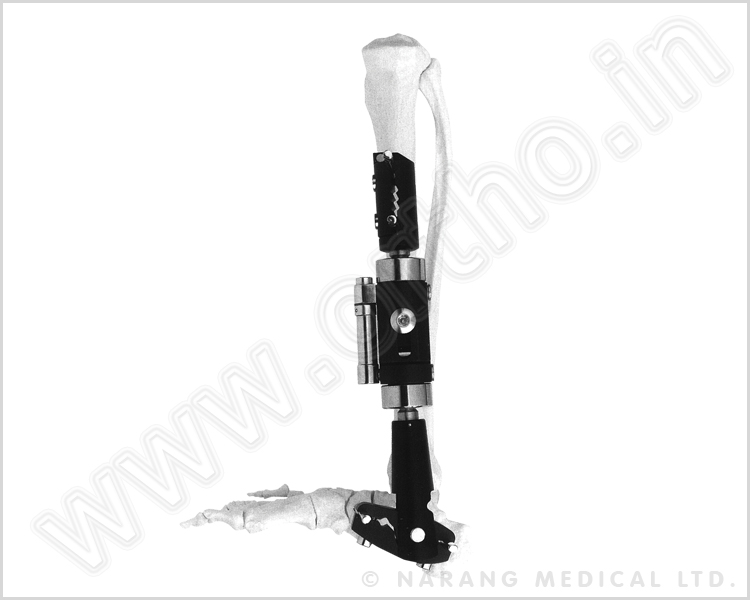 Dynamic Axial Extenal Fixator (Ankle Joint Type) - Medium