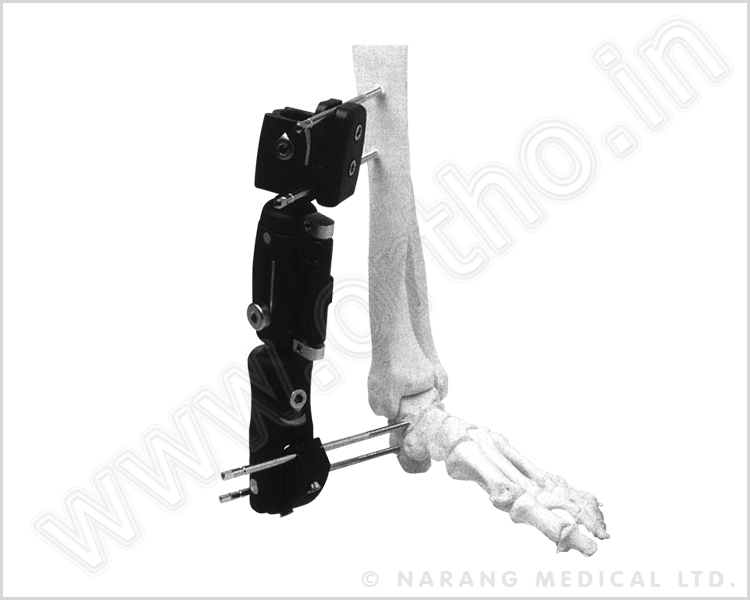 Tibia External Fixator (Radiolucent Design) L/S