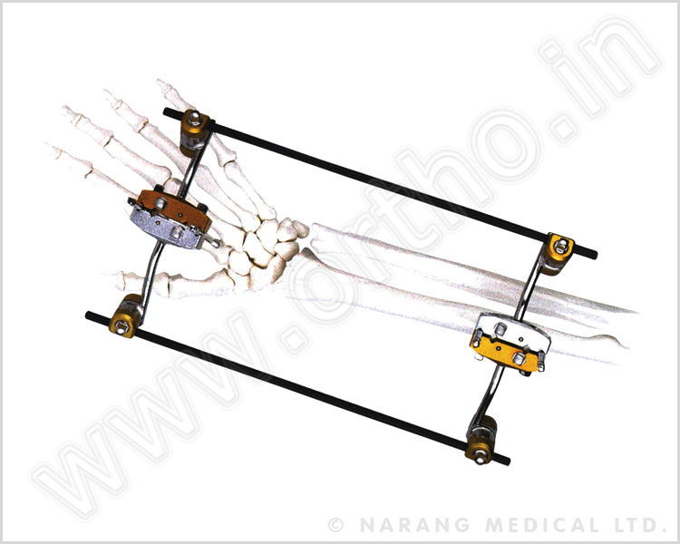 Q.5010    Ulna & Radius Connecting External Fixator