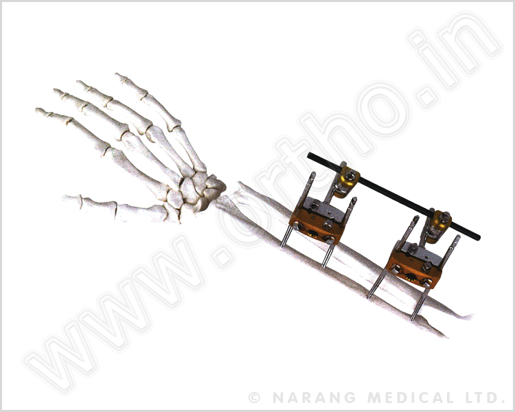 Q.5020    Ulna & Radis (Forearm) Fixator