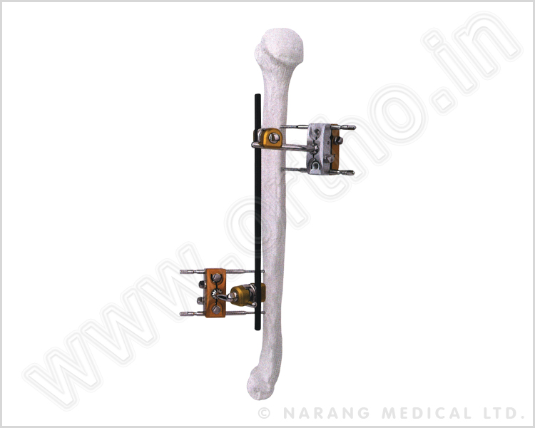 Q.5050    Humeral Shaft External Fixator