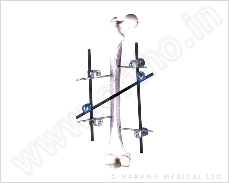 Q.5220 Femoral Shaft Fixator