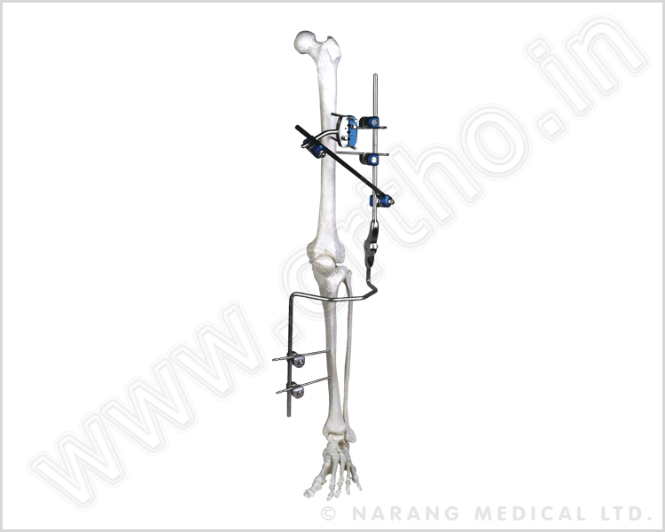 Q.5270    Knee Joint Fixator