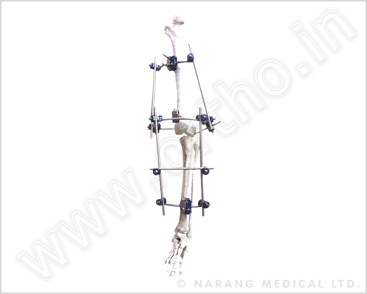 Q.5310    Knee Joint External Fixator