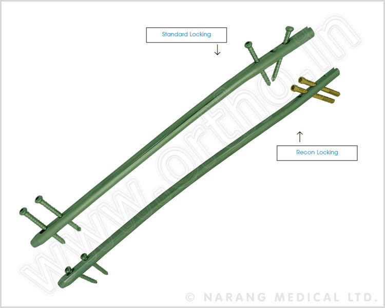 Perfect Femoral Nail - Cannulated (Long) for Right Leg