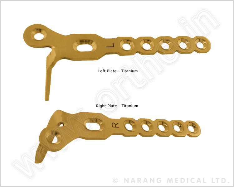 Condylar Plate