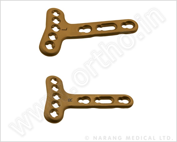 Variable Angle Volar Distal Radius Safety Lock Plate 2.4, Extra Articular (5 Head Holes)