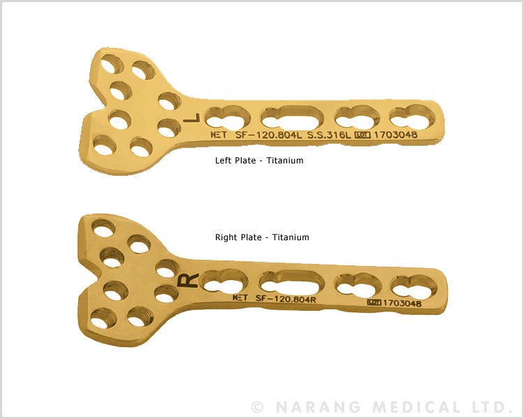 Volar Column Distal Radius Safety Lock Plate 2.4 (8 Head Holes)